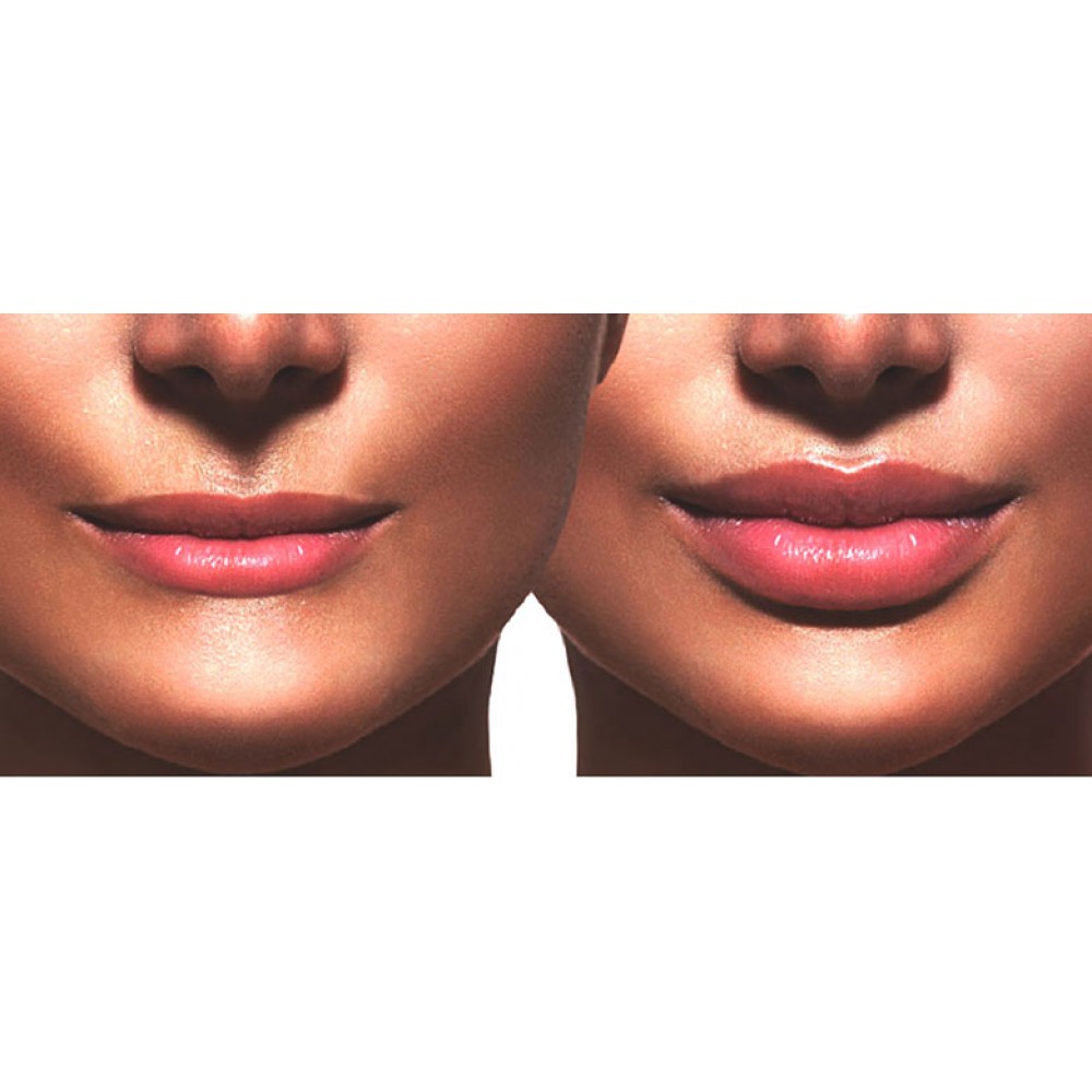 Приложение увеличивающее губы. Форма губ для увеличения. Плоские увеличенные губы. Форма губ бантиком.
